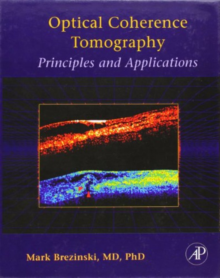 Optical Coherence Tomography