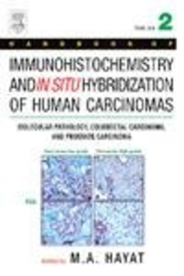 Handbook of Immunohistochemistry and in Situ Hybridization of Human Carcinomas