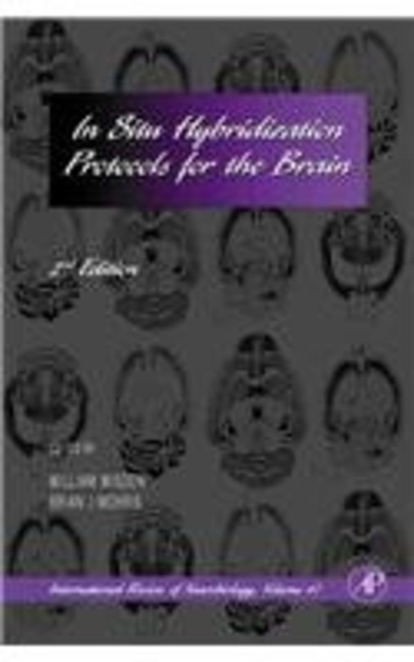 In Situ Hybridization Protocols for the Brain