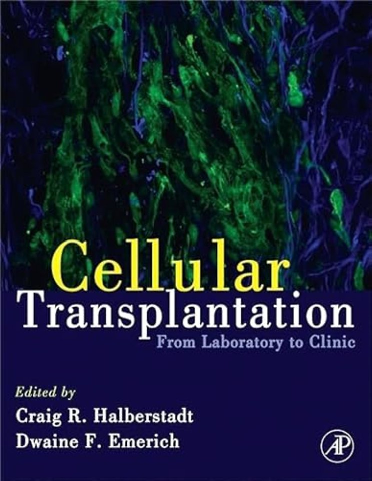 Cellular Transplantation