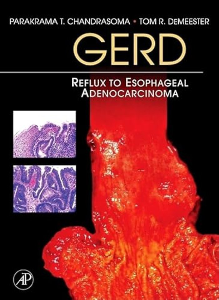 GERD