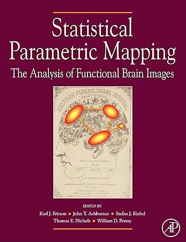 Statistical Parametric Mapping: The Analysis of Functional Brain Images