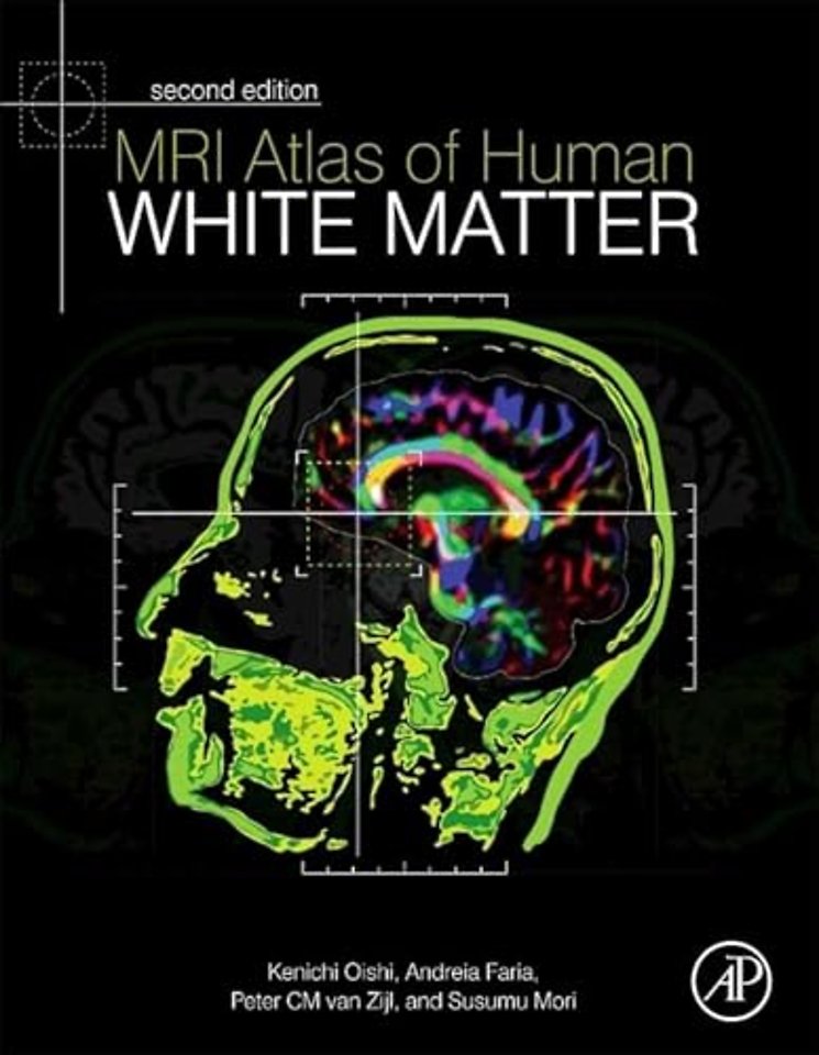 MRI Atlas of Human White Matter