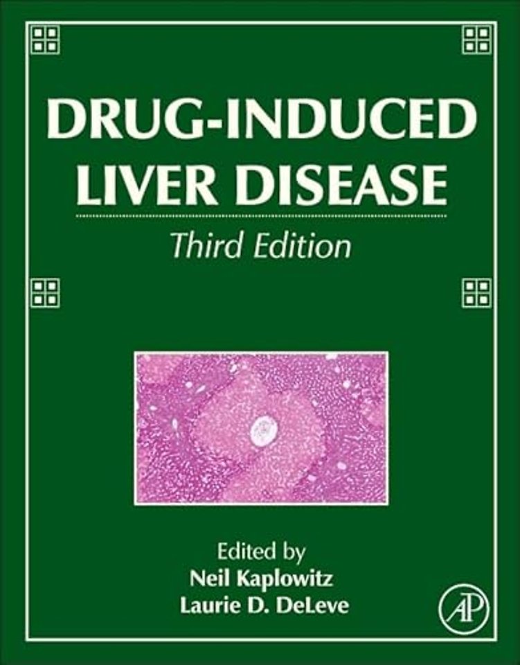 Drug-Induced Liver Disease