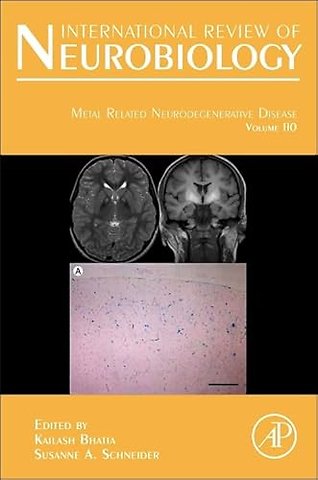 Metal Related Neurodegenerative Disease