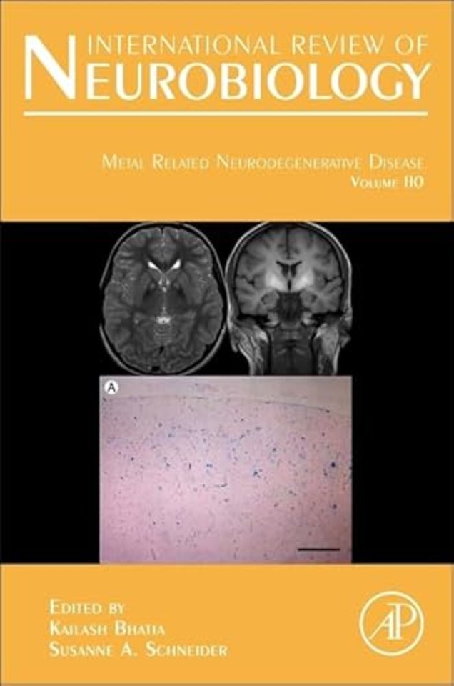 Metal Related Neurodegenerative Disease