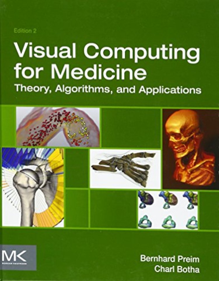 Visual Computing for Medicine