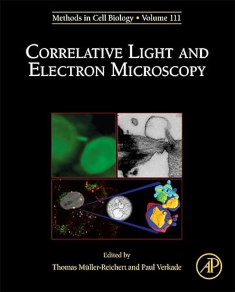 Correlative Light and Electron MIcroscopy