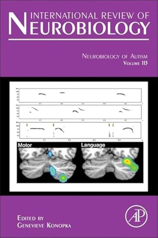 Neurobiology of Autism