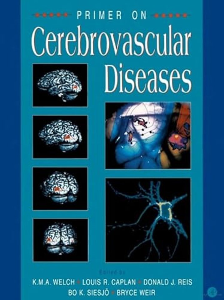 Primer on Cerebrovascular Diseases