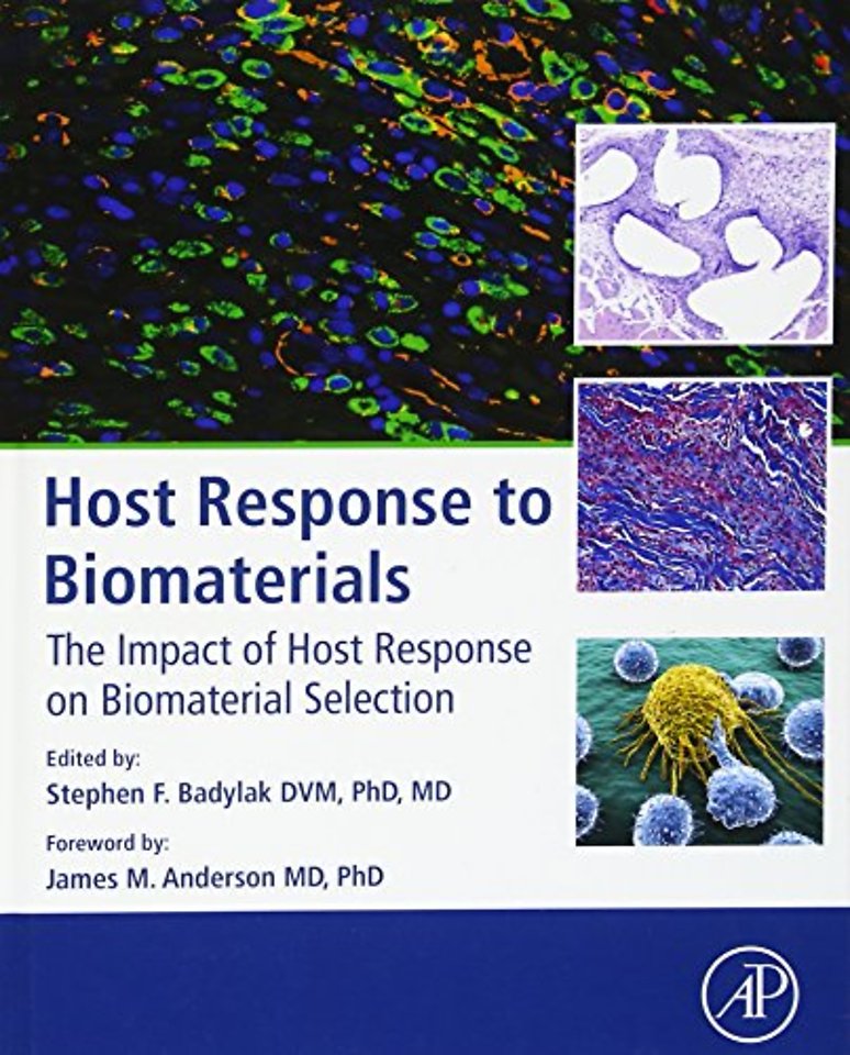 Host Response to Biomaterials
