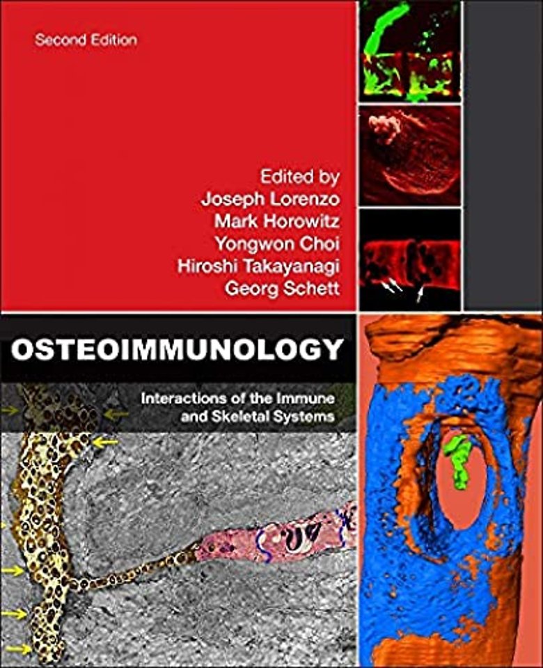 Osteoimmunology