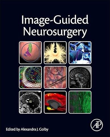 Image-Guided Neurosurgery