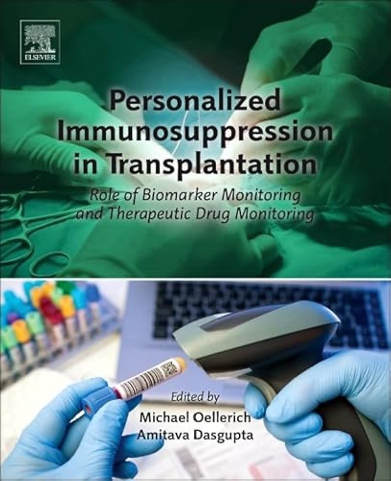 Personalized Immunosuppression in Transplantation