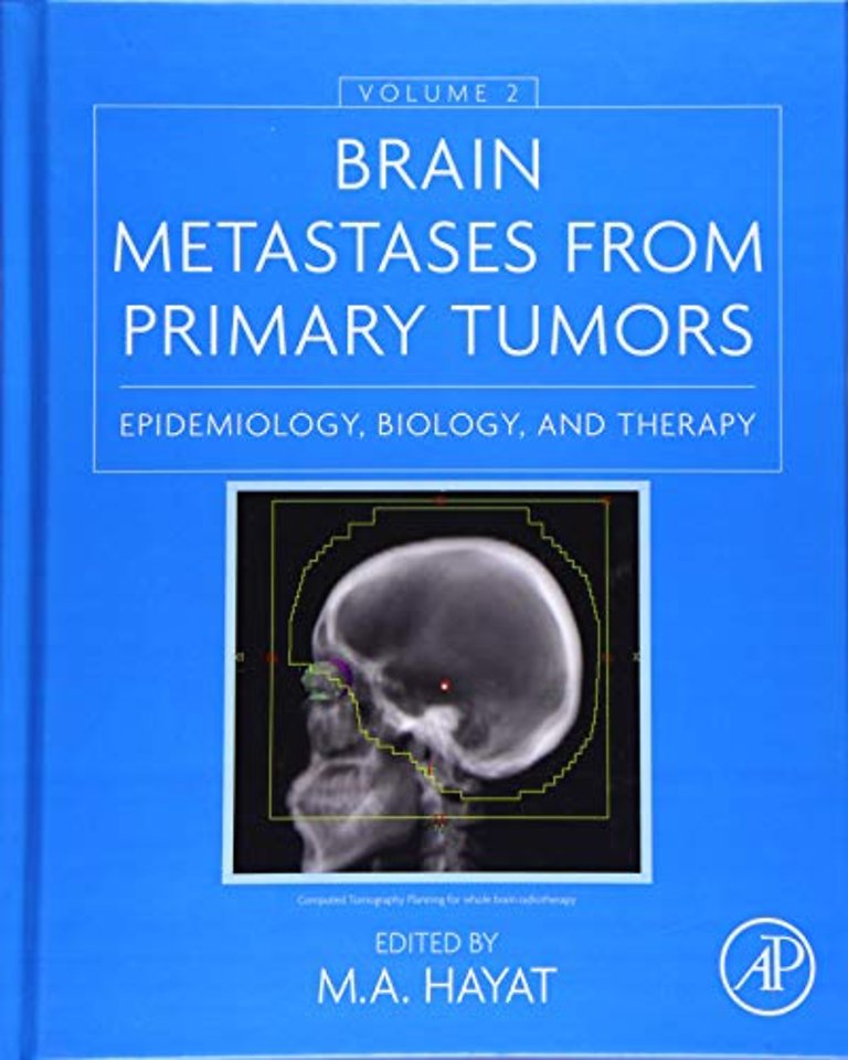 Brain Metastases from Primary Tumors, Volume 2