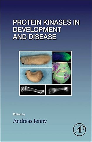 Protein Kinases in Development and Disease