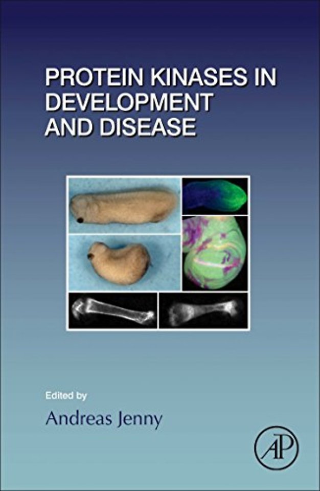 Protein Kinases in Development and Disease