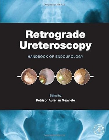 Retrograde Ureteroscopy