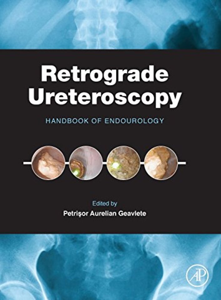 Retrograde Ureteroscopy