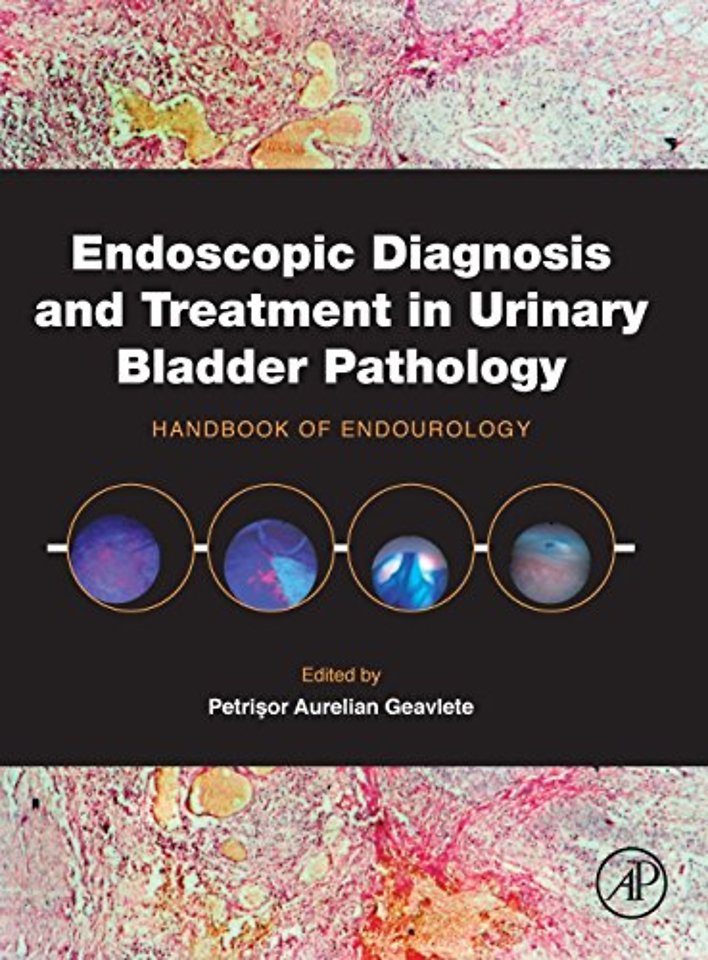 Endoscopic Diagnosis and Treatment in Urinary Bladder Pathology