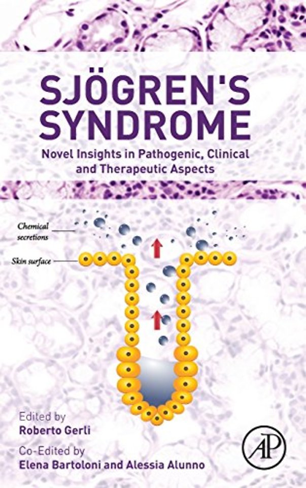Sjogren's Syndrome