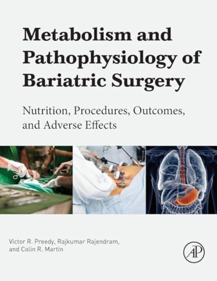 Metabolism and Pathophysiology of Bariatric Surgery