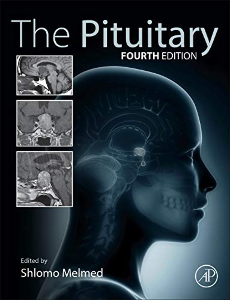 The Pituitary