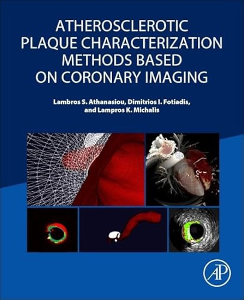 Atherosclerotic Plaque Characterization Methods Based on Coronary Imaging