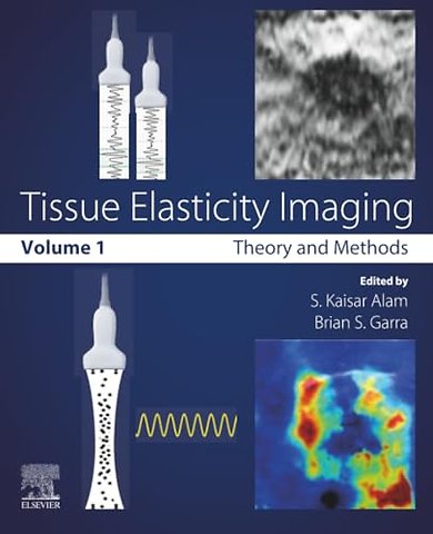 Tissue Elasticity Imaging