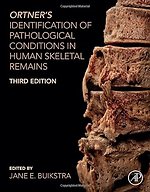 Ortner's Identification of Pathological Conditions in Human Skeletal Remains