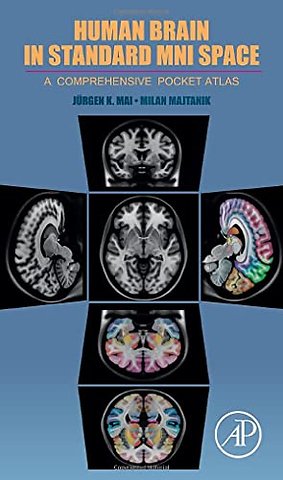 Human Brain in Standard MNI Space