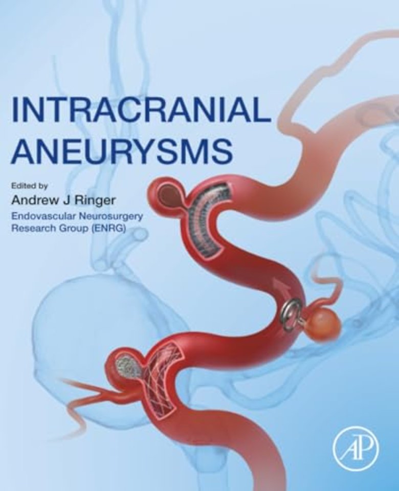 Intracranial Aneurysms