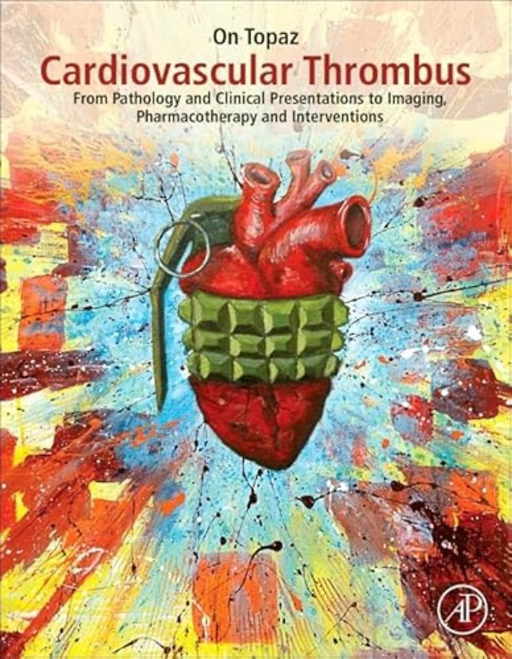 Cardiovascular Thrombus