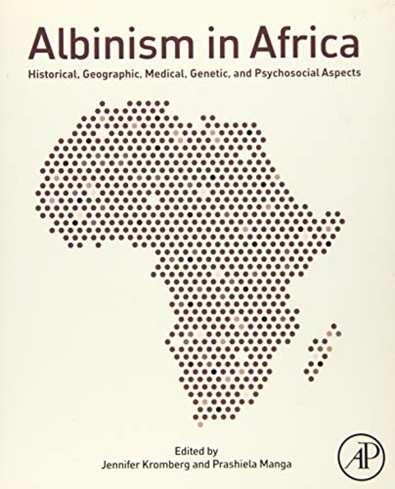 Albinism in Africa