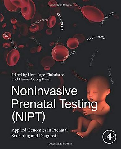 Noninvasive Prenatal Testing (NIPT)