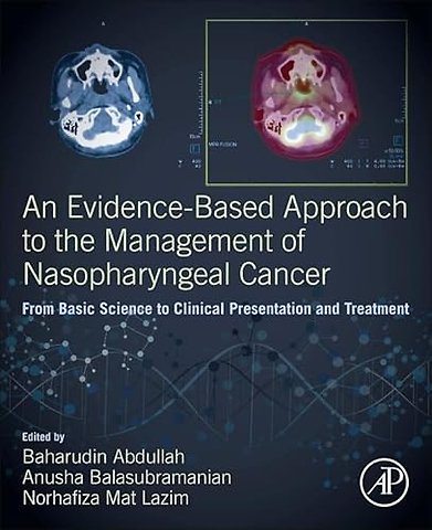 An Evidence-Based Approach to the Management of Nasopharyngeal Cancer