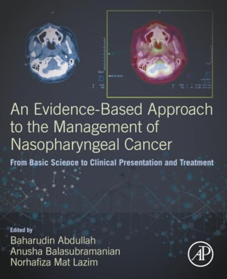 An Evidence-Based Approach to the Management of Nasopharyngeal Cancer