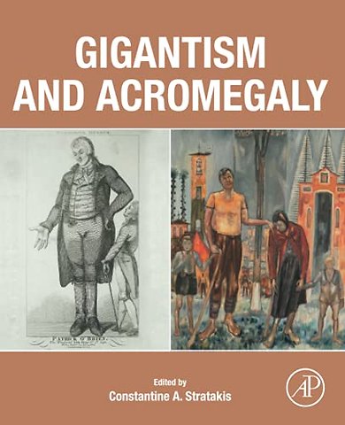 Gigantism and Acromegaly