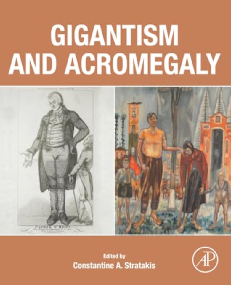 Gigantism and Acromegaly