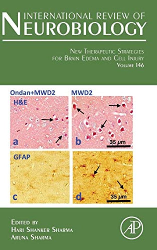 New Therapeutic Strategies for Brain Edema and Cell Injury
