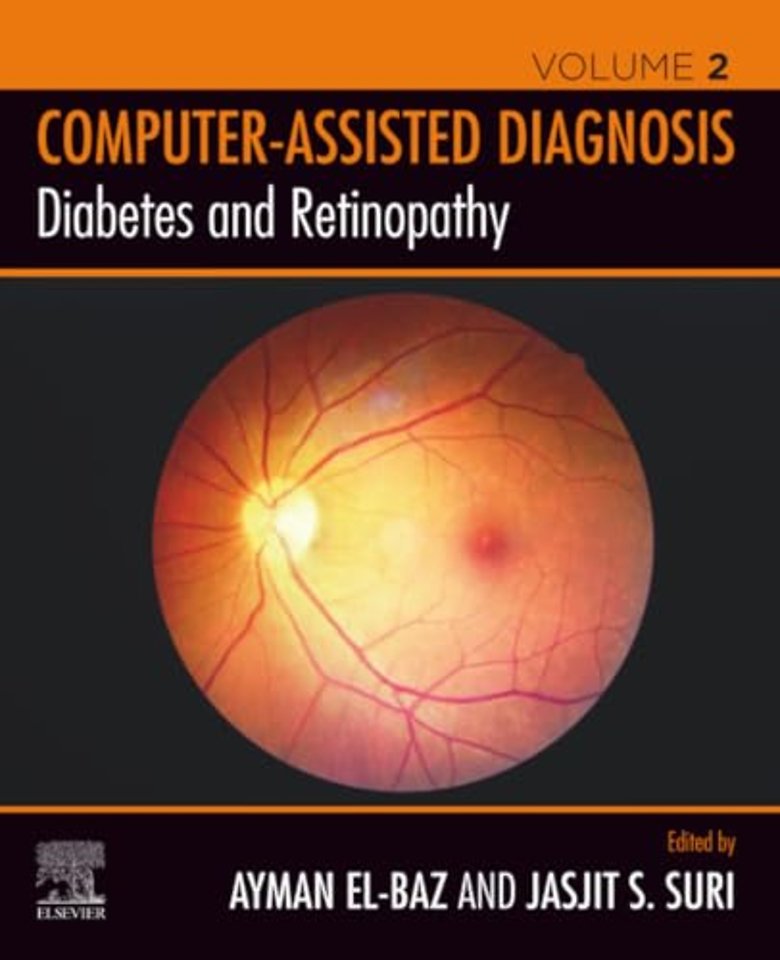 Diabetes and Retinopathy