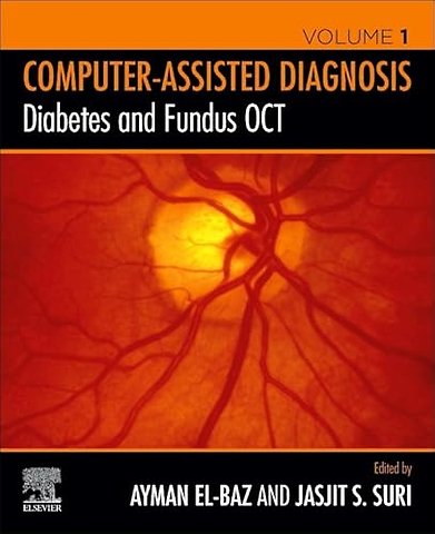 Diabetes and Fundus OCT