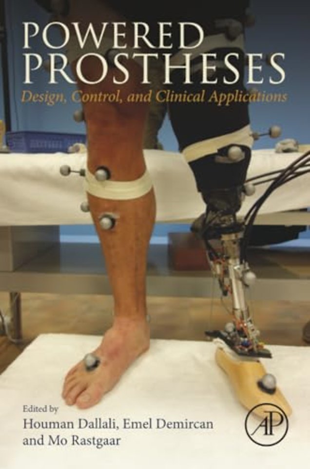 Powered Prostheses
