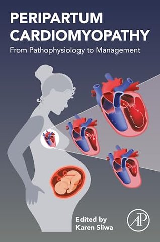 Peripartum Cardiomyopathy