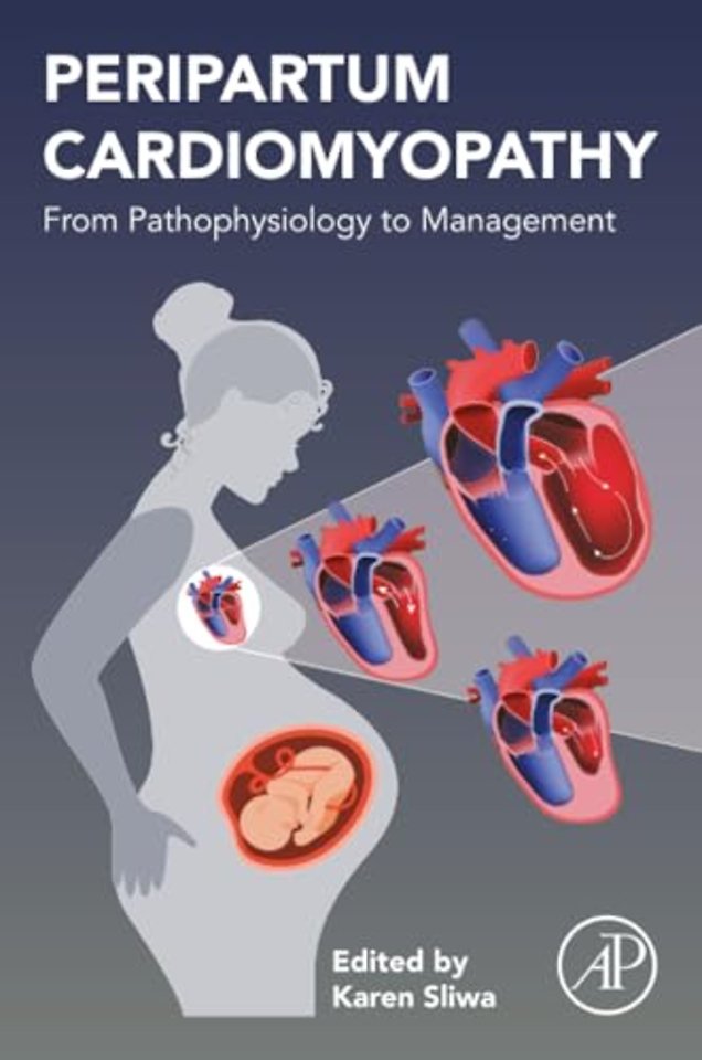 Peripartum Cardiomyopathy