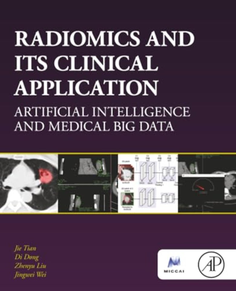 Radiomics and Its Clinical Application