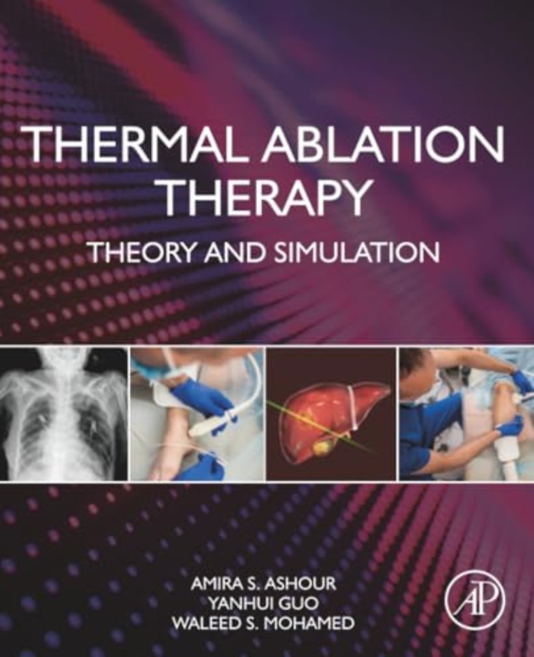 Thermal Ablation Therapy