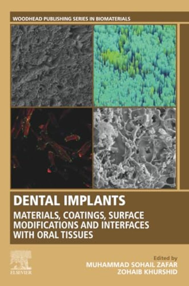 Dental Implants