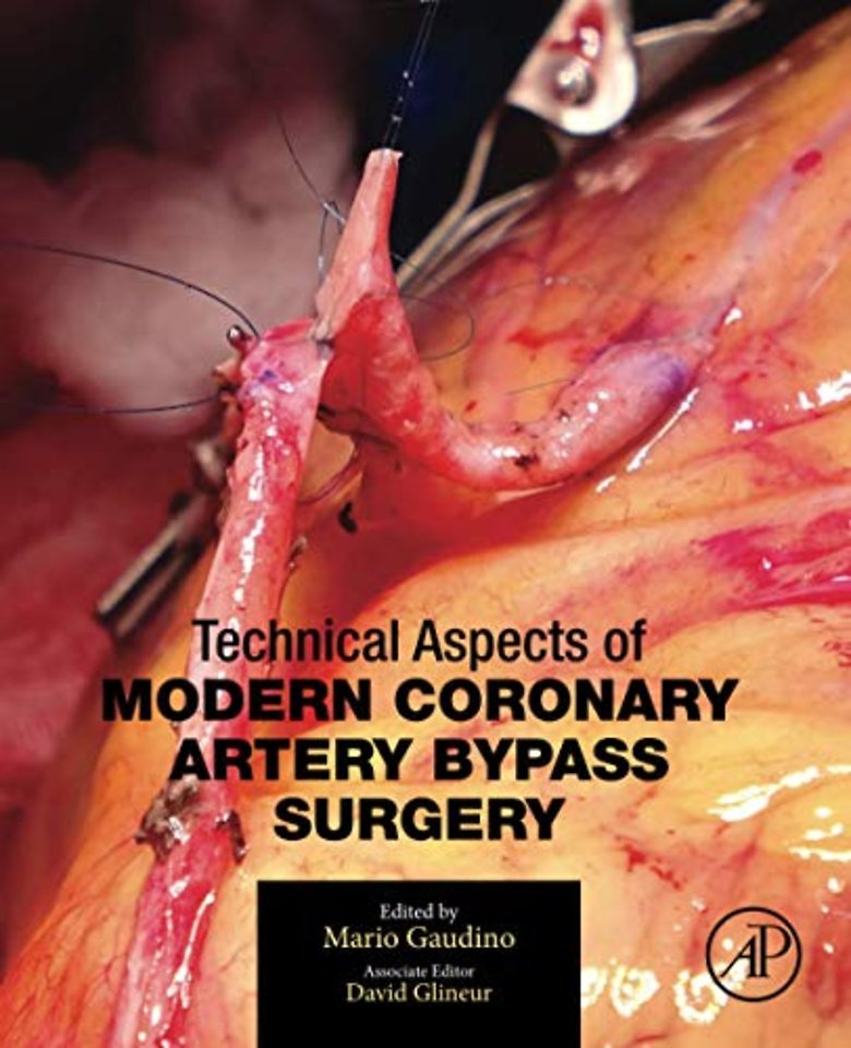 Technical Aspects of Modern Coronary Artery Bypass Surgery
