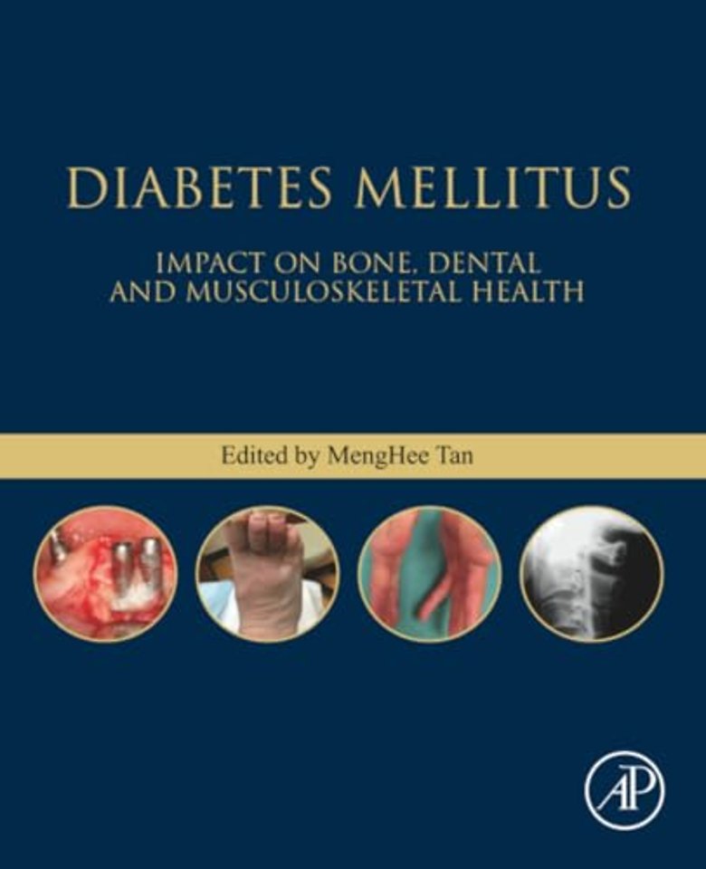 Diabetes Mellitus